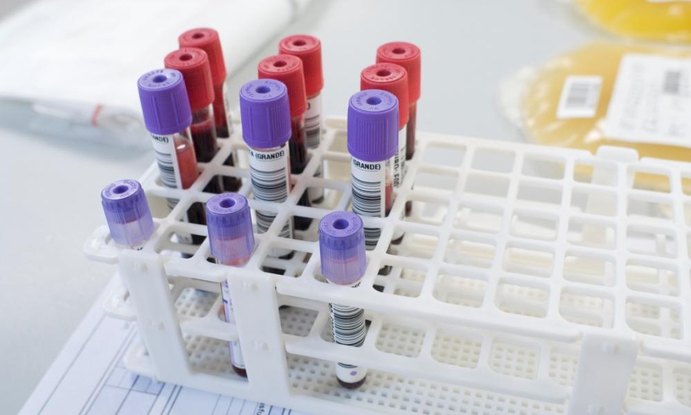 Pathogen Inactivation Costs