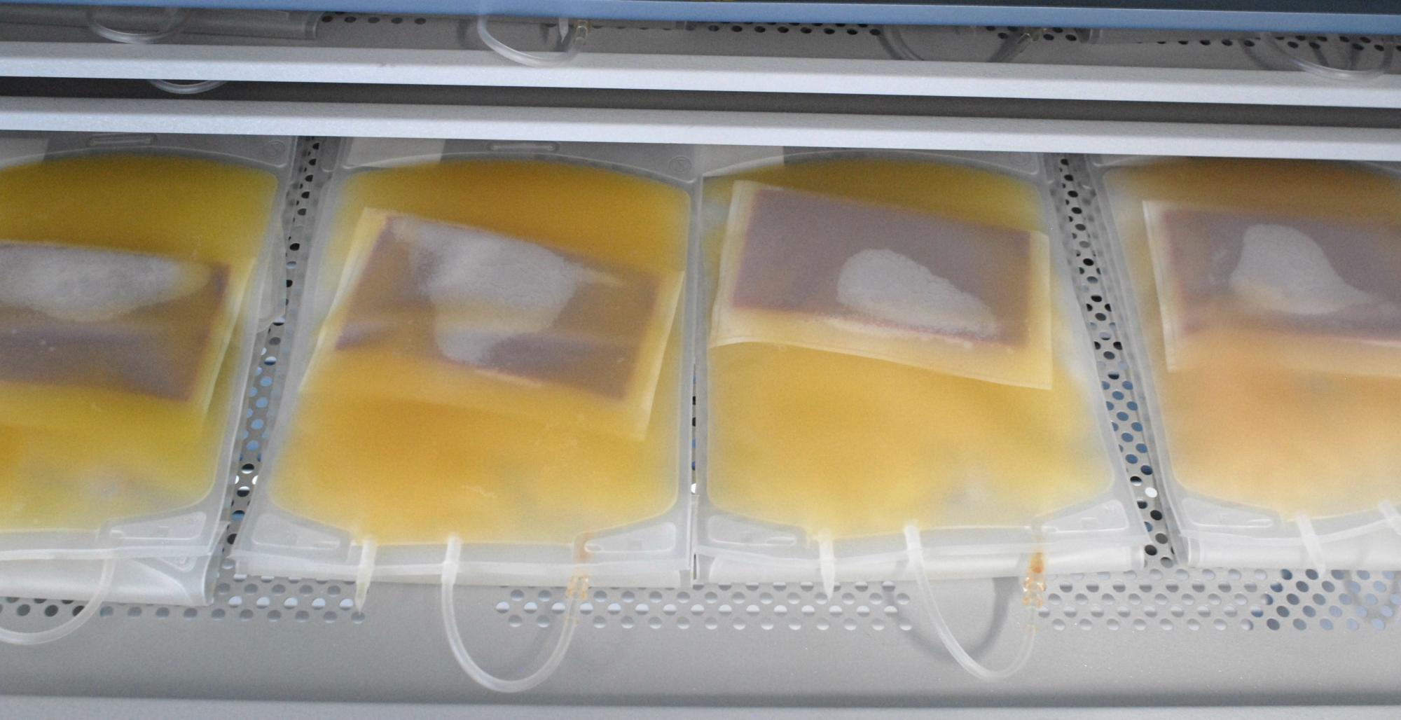 multiple_platelets_3.jpg multiple_platelets_3.jpg